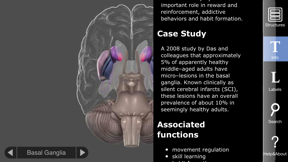 3D Brain screenshot