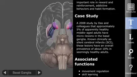 3D Brain