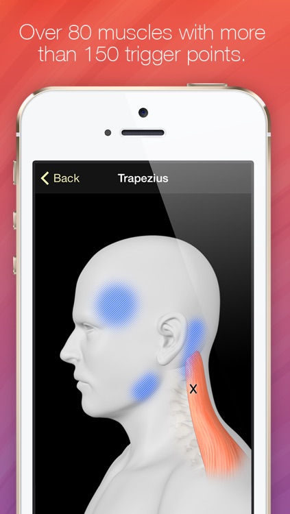 Trigger Points - Guide & Reference screenshot-0