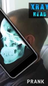 Simulator X-Ray Head screenshot #1 for iPhone