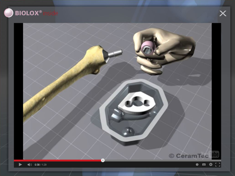 BIOLOX inside iPad screenshot 5 - Medical app