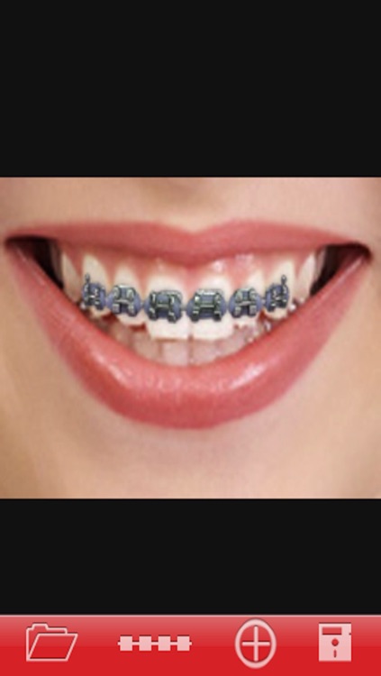 Orthodontic تقويم الاسنان