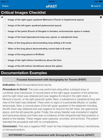 SonoSupport: a clinical emergency medicine and critical care ultrasound reference toolのおすすめ画像3