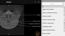 cbct iphone resimleri 1
