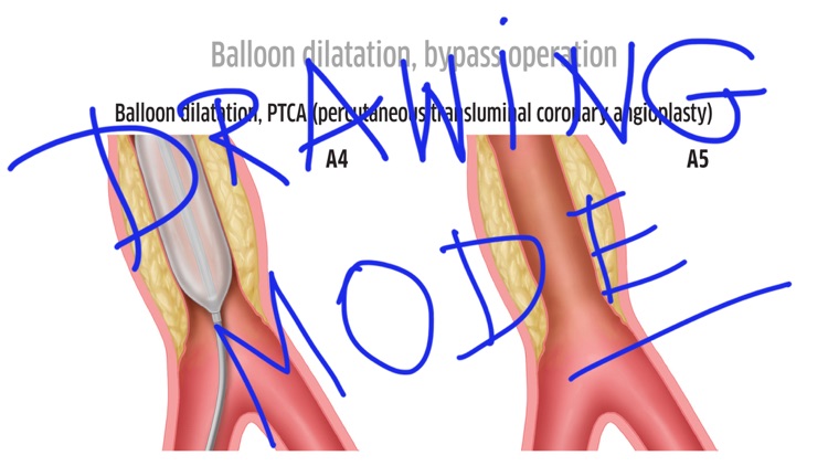 Patient Education Institute screenshot-3