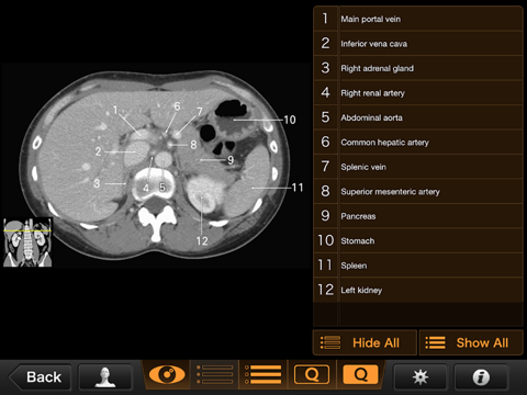 Screenshot #6 pour Interactive CT and MRI Anatomy