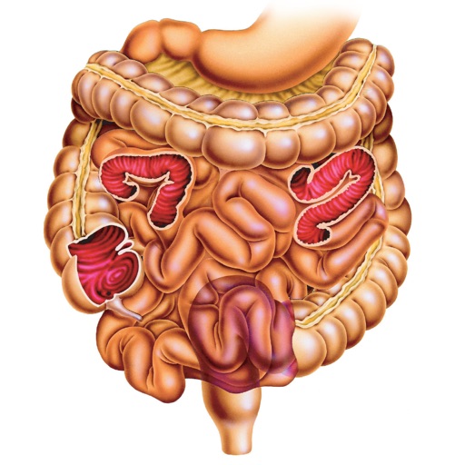 Miniatlas Gastroenterology