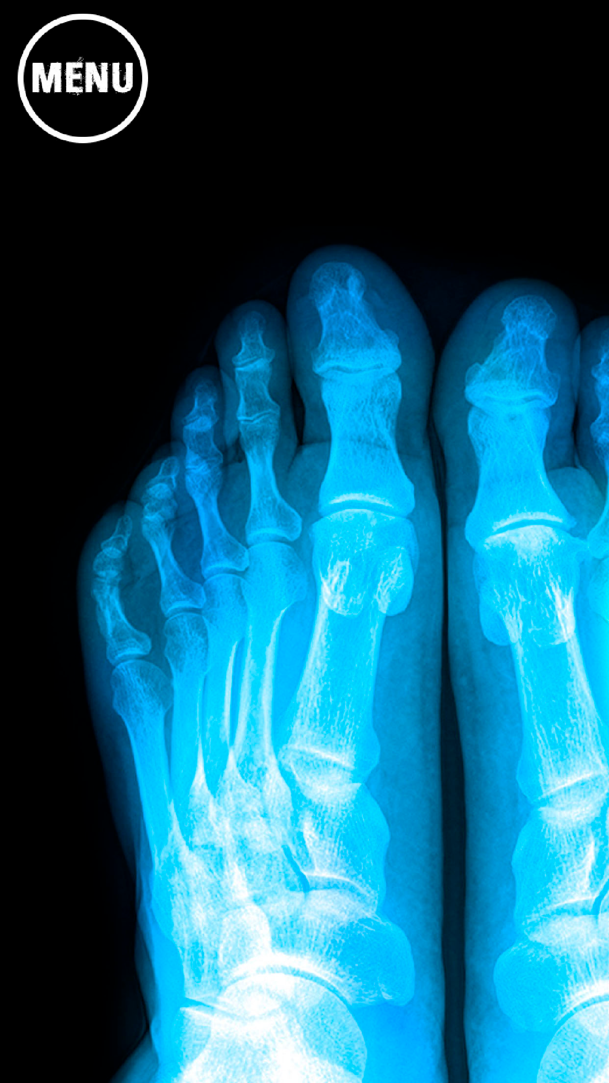 Laser X Ray Pointer Prank