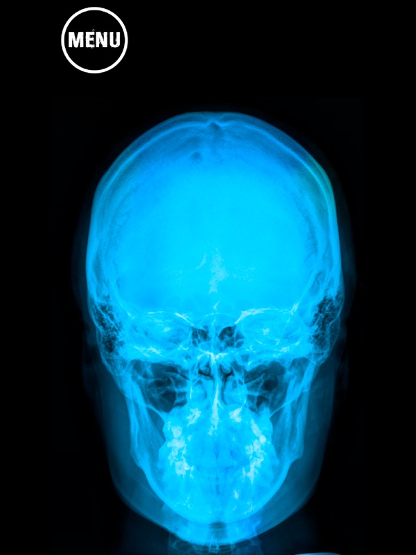 Laser X Ray Pointer Prank screenshot 5