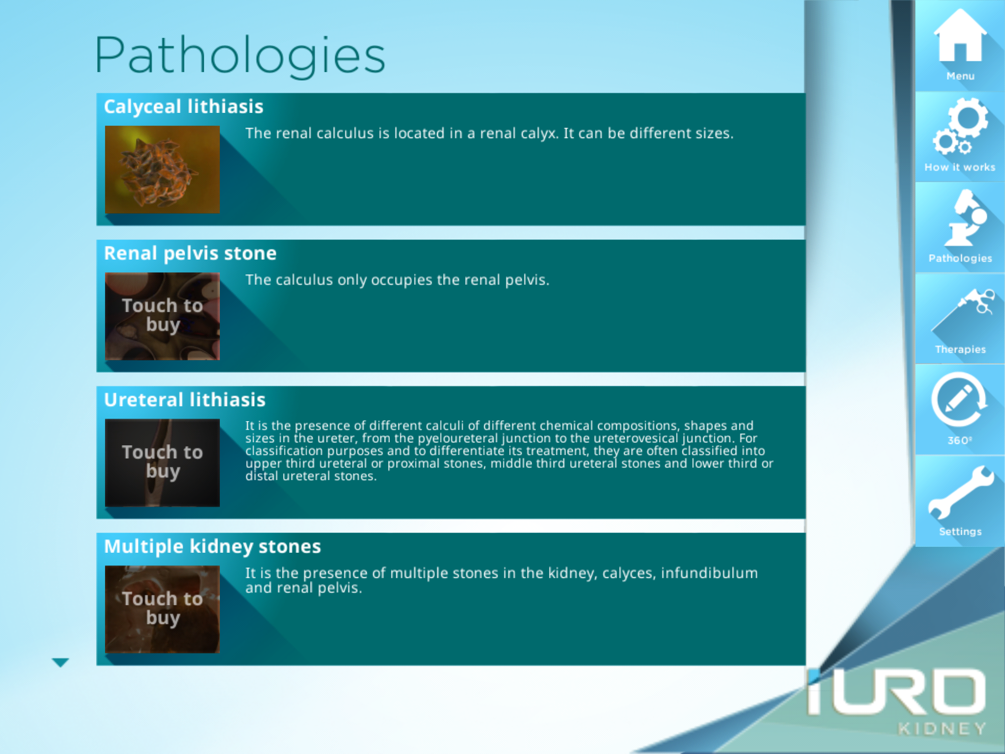 iURO Kidney Lite