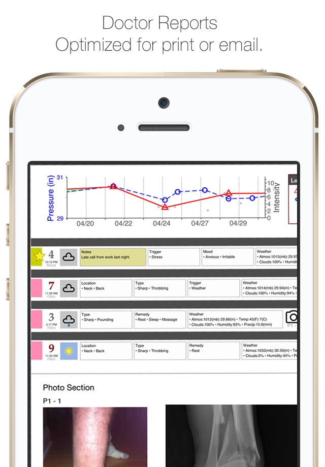 My Pain Diary: Chronic Pain & Symptom Tracker screenshot 4