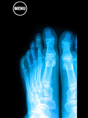 Screenshot #6 pour Laser X Ray Pointer Prank
