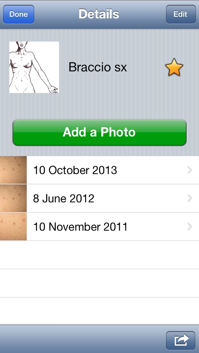 Skin Prevention – Photo Body Map for Melanoma and Skin Cancer early detection Screenshot 3