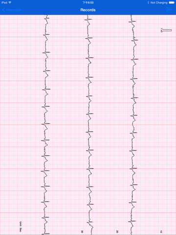 Screenshot #4 pour iBP ECG