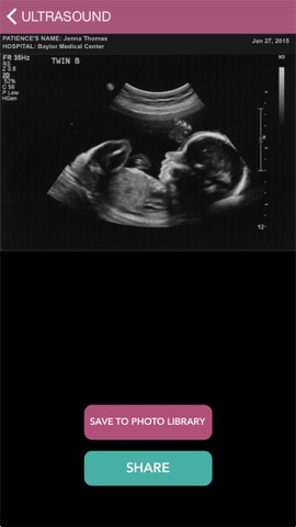 Baby Ultrasound 2015のおすすめ画像1