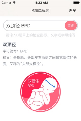 B超单解读 screenshot 2