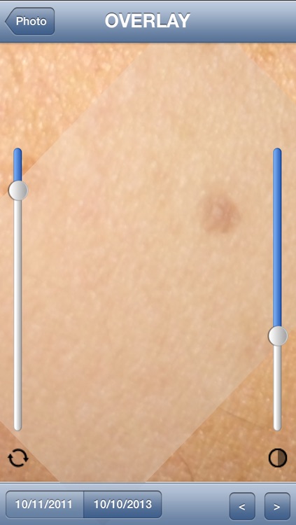 Skin Prevention – Photo Body Map for Melanoma and Skin Cancer early detection screenshot-4