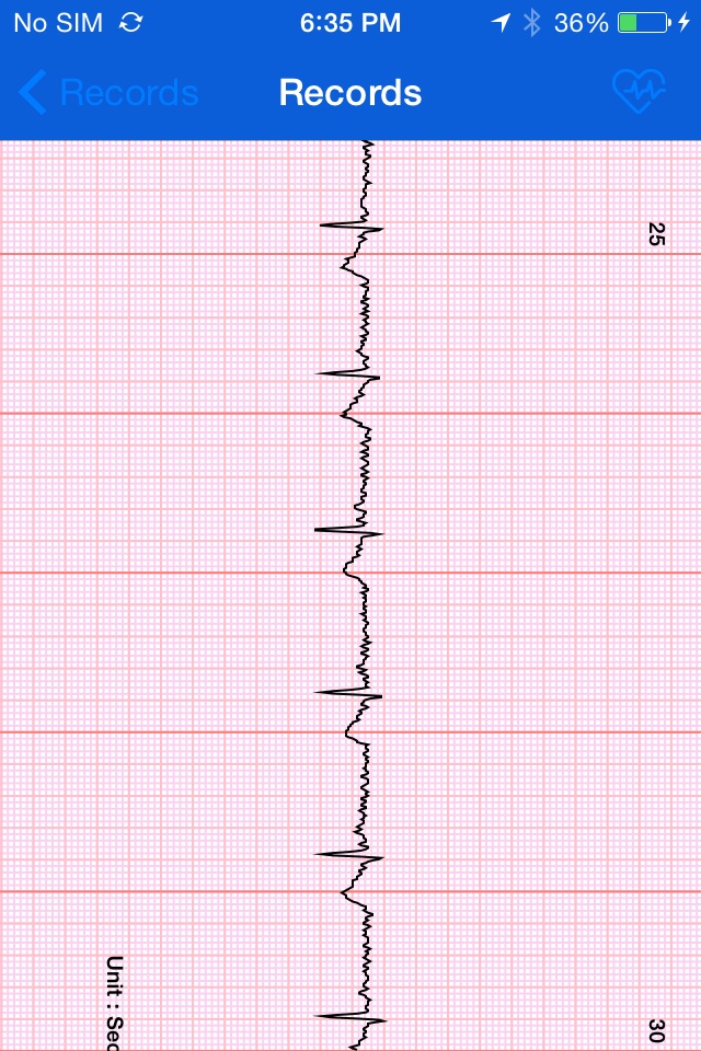 iBP ECG screenshot 3