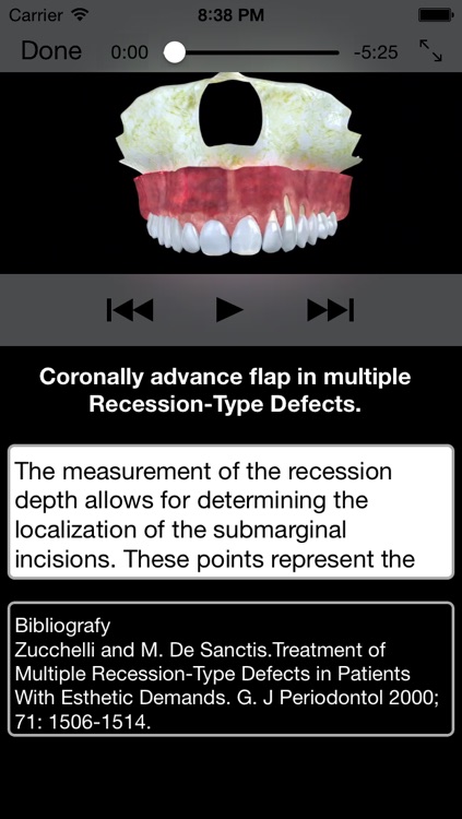 Periodontal Advanced Surgery By Mariano Sanz