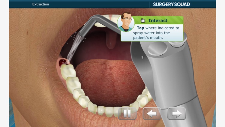 Surgery Squad's Wisdom Tooth Extraction screenshot-3