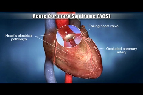 Medrills: Cardiac Emergencies screenshot 2