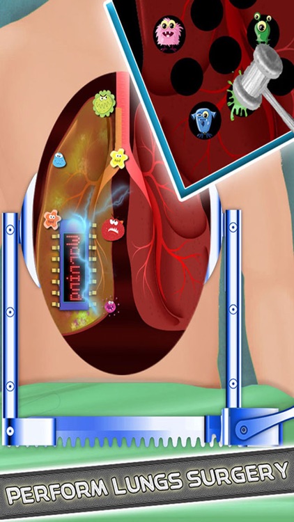 Lung Surgery Doctor - Hospital Game screenshot-3