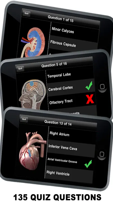 Anatomy 3D - Organs screenshot 3 of 5