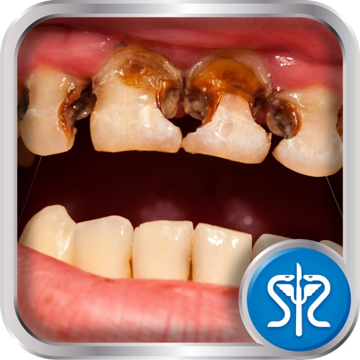 Surgery Squad's Dental Filling iOS App