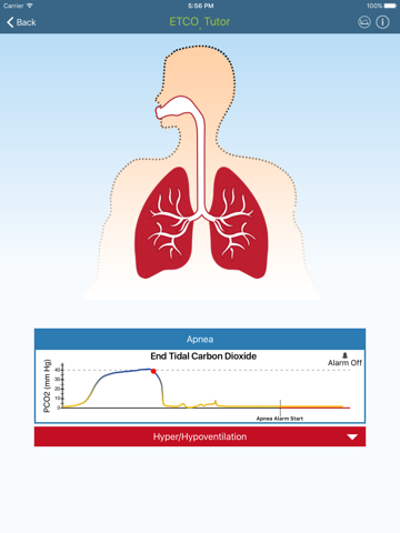 Screenshot #5 pour ETCO2 Tutor