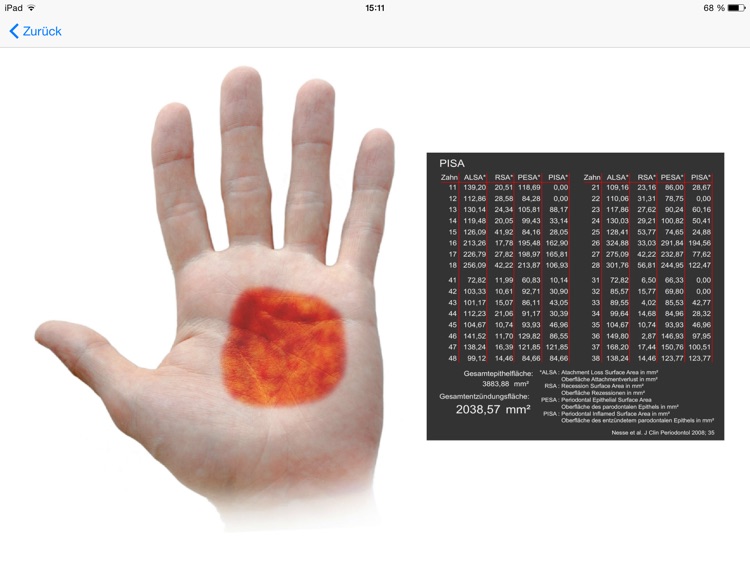 ParoStatus.de SideView