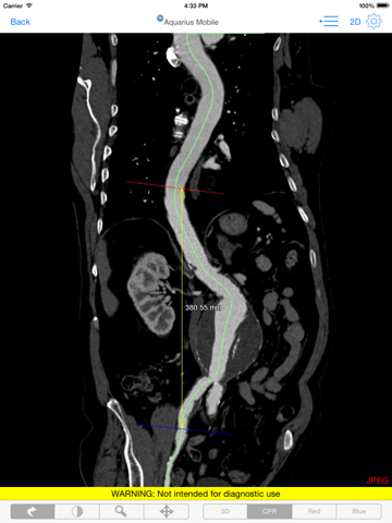 Aquarius Mobile iPad screenshot 4 - Medical app