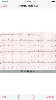 How to cancel & delete photo ekg 4