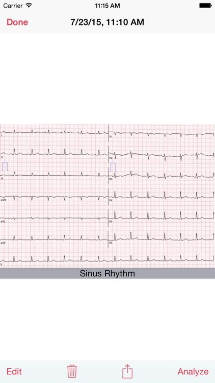 Photo EKG screenshot-3