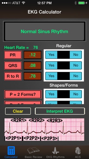 EKG Calculator