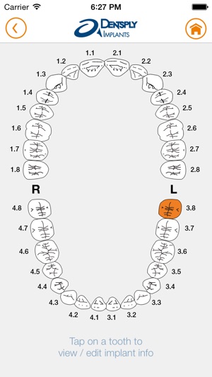 DENTSPLY Implants(圖3)-速報App