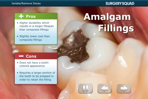 Surgery Squad's Dental Filling screenshot 3