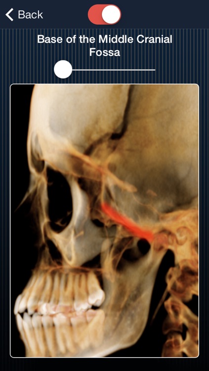 Dental Panoramic Radiology screenshot-3