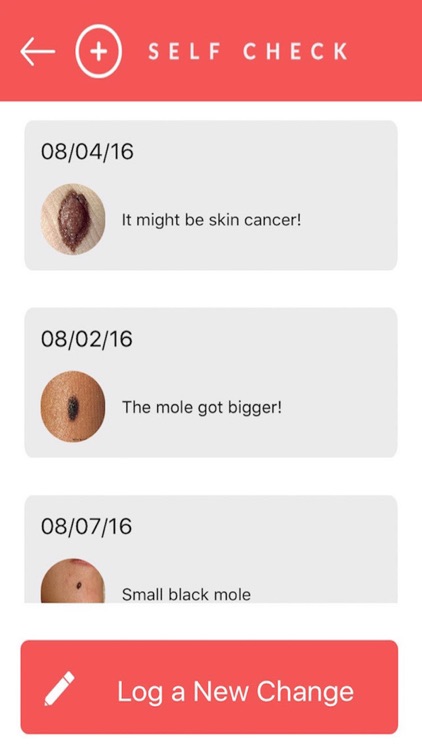 SelfCheck - Skin Cancer Prevention screenshot-3