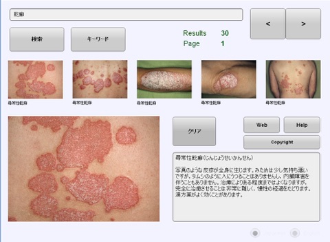 YSP Dermatology Image Database for iPad screenshot 2