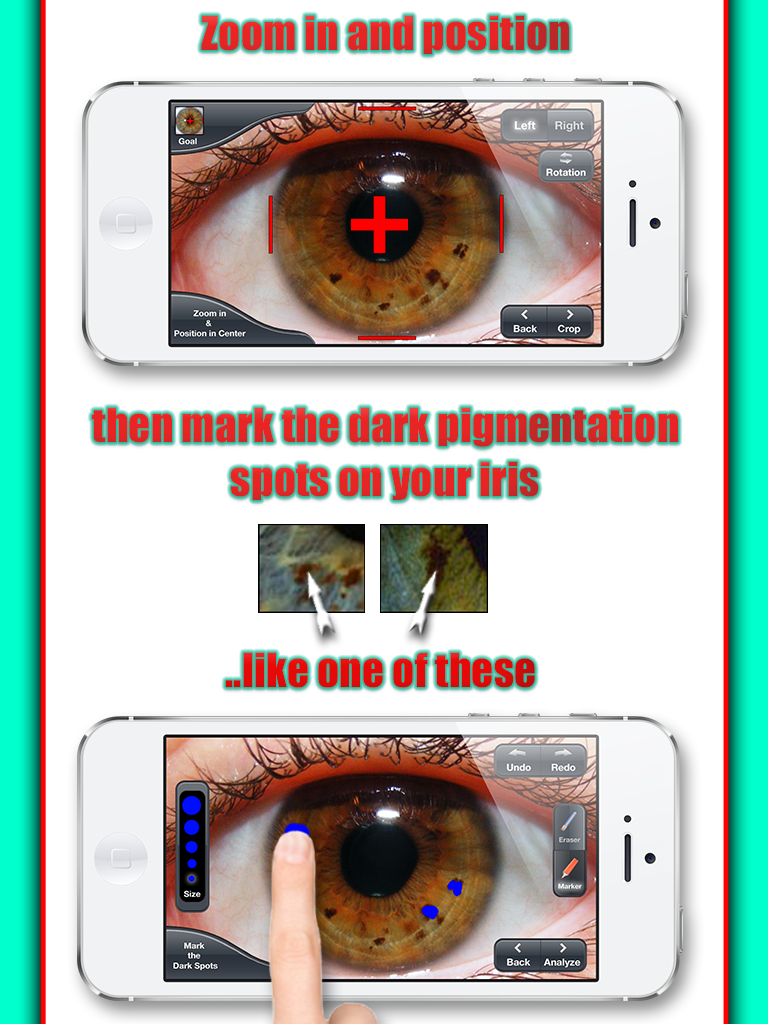 Health Test - The iridology app