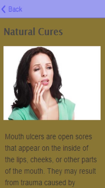 How To Get Rid Of Mouth Ulcers