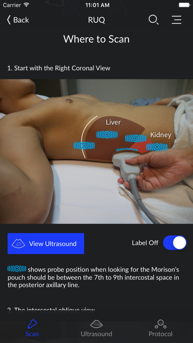 RESUS Ultrasound LITEのおすすめ画像2