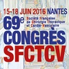 SFCTCV