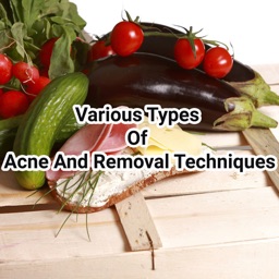Acne And Removal Techniques