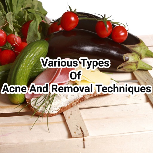 Acne And Removal Techniques