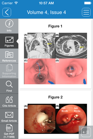 Respirology Case Reports screenshot 2