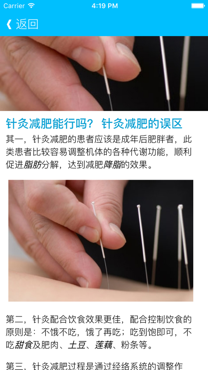 中国中医针灸学 - 人体针灸经络穴位图解,传承针灸养生疗法 screenshot 2