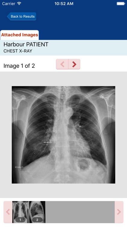 Harbour Radiology Patient Access