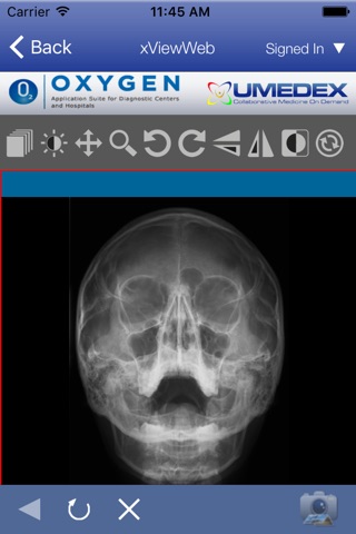 UMEDEX OXYGEN App Suite screenshot 4