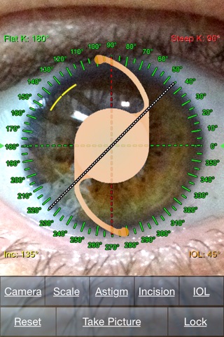 Toric Lab - Simulations for Toric IOL screenshot 3